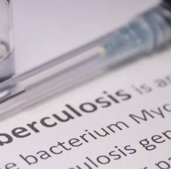 Waspada! WHO Catat Kasus TB di Dunia Cetak Rekor Tertinggi