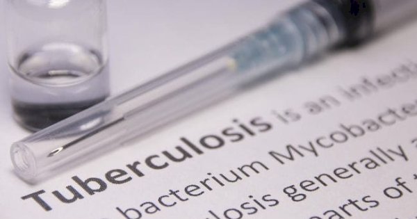 Waspada! WHO Catat Kasus TB di Dunia Cetak Rekor Tertinggi