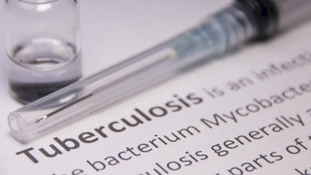 Ilustrasi penyakit TB.(F-INT)